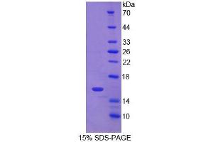 Image no. 1 for CD7 (CD7) (AA 26-134) protein (T7 tag,His tag) (ABIN6238898)