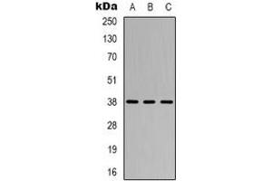 Image no. 3 for anti-Cysteinyl Leukotriene Receptor 1 (CYSLTR1) antibody (ABIN2801448)