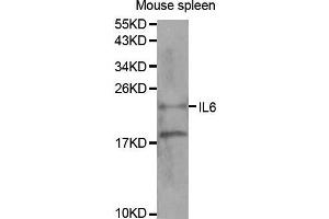 Western Blotting (WB) image for anti-Interleukin 6 (IL6) (AA 30-212) antibody (ABIN1513075)