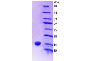 Image no. 4 for S100 Calcium Binding Protein A9 (S100A9) ELISA Kit (ABIN6730867)