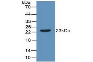 IL-2 Antikörper  (AA 10-169)