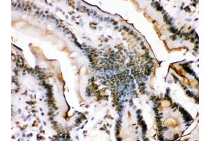 Image no. 1 for anti-FBJ Murine Osteosarcoma Viral Oncogene Homolog B (FOSB) (AA 264-291), (C-Term) antibody (ABIN3042399)