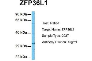 Image no. 1 for anti-ZFP36 Ring Finger Protein-Like 1 (ZFP36L1) (N-Term) antibody (ABIN2777899)