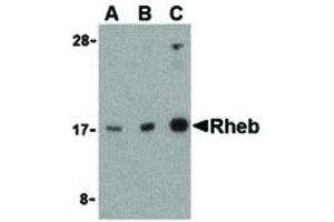 Image no. 1 for anti-Ras Homolog Enriched in Brain (RHEB) (Internal Region) antibody (ABIN6656361)