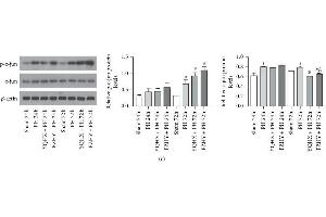 Image no. 5 for anti-Jun Proto-Oncogene (JUN) (pSer73) antibody (ABIN3019560)