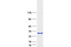 Image no. 1 for GLI Pathogenesis-Related 2 (GLIPR2) protein (Myc-DYKDDDDK Tag) (ABIN2721691)