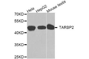 Image no. 1 for anti-TAR (HIV-1) RNA Binding Protein 2 (TARBP2) antibody (ABIN6148851)