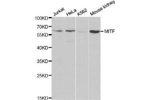 Image no. 1 for anti-Microphthalmia-Associated Transcription Factor (MITF) antibody (ABIN3021855)