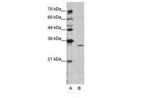 Image no. 2 for anti-Guanine Nucleotide Binding Protein (G Protein), beta Polypeptide 1-Like (GNB1L) (C-Term) antibody (ABIN202254)