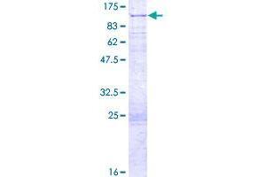 Image no. 1 for Vertebrae Development Associated (VRTN) (AA 1-702) protein (GST tag) (ABIN1347144)
