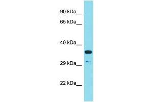 Image no. 1 for anti-R-Spondin 3 (RSPO3) (C-Term) antibody (ABIN2788532)
