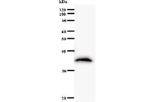Image no. 1 for anti-Transcription Factor Dp-2 (E2F Dimerization Partner 2) (TFDP2) antibody (ABIN930919)