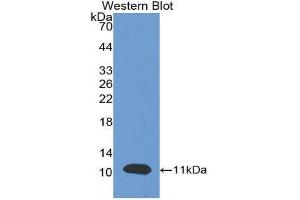 Image no. 1 for anti-Brain Natriuretic Peptide (BNP) (AA 27-134) antibody (ABIN1077872)