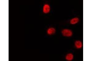 Image no. 2 for anti-Hepatic Leukemia Factor (HLF) antibody (ABIN6262296)