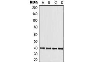 Image no. 1 for anti-Tribbles Homolog 3 (Drosophila) (TRIB3) (N-Term) antibody (ABIN2707768)