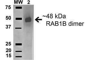 Image no. 1 for anti-RAB1B, Member RAS Oncogene Family (RAB1B) (AA 179-189) antibody (FITC) (ABIN5066509)
