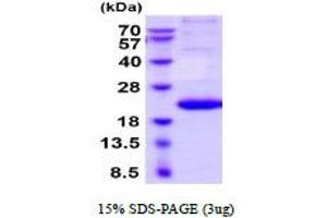 Image no. 1 for Interleukin 29 (IL29) (AA 20-200) (Active) protein (His tag) (ABIN5854674)