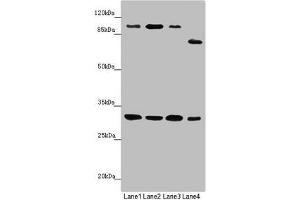 MTIF3 Antikörper  (AA 1-278)