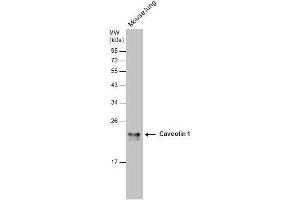 WB Image Caveolin 1 antibody [N1N3] detects Caveolin 1 protein by western blot analysis.