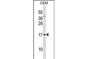 VPREB1 Antibody (Center) (ABIN1538592 and ABIN2838302) western blot analysis in CEM cell line lysates (35 μg/lane).