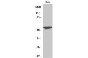 Image no. 1 for anti-serine/threonine Kinase 33 (STK33) (N-Term) antibody (ABIN3187099)