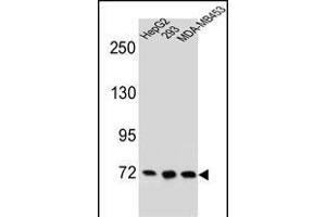ZNF860 抗体  (C-Term)