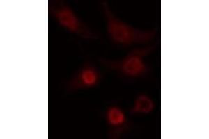 ABIN6274267 staining COLO205 cells by IF/ICC.