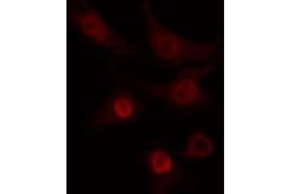 CLK2 antibody  (N-Term)