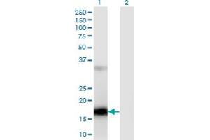 Image no. 1 for anti-Zinc Finger, C3HC-Type Containing 13 (ZCCHC13) (AA 1-166) antibody (ABIN949969)
