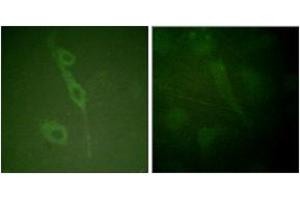 Immunofluorescence analysis of HuvEc cells, using IL-7R/CD127 (Phospho-Tyr449) Antibody.