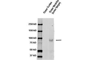 Image no. 2 for anti-Sodium Channel, Nonvoltage-Gated 1, beta (SCNN1B) (AA 617-638) antibody (FITC) (ABIN2486411)