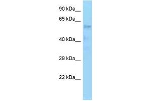 anti-Zinc Finger Protein 20 (ZNF20) (C-Term) antibody