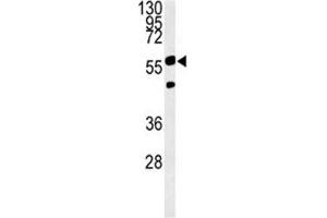 Image no. 1 for anti-phosphoglycerate Dehydrogenase (PHGDH) (AA 249-277) antibody (ABIN3032220)