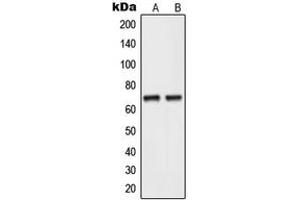 Image no. 2 for anti-Nei Endonuclease VIII-Like 3 (NEIL3) (C-Term) antibody (ABIN2705029)