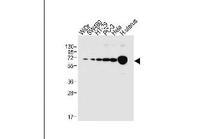 All lanes : Anti-NOX1 Antibody (Center) at 1:1000 dilution Lane 1: WiDr whole cell lysate Lane 2: S whole cell lysate Lane 3: HT-29 whole cell lysate Lane 4: PC-3 whole cell lysate Lane 5: Hela whole cell lysate Lane 6: human uterus tissue lysate Lysates/proteins at 20 μg per lane.
