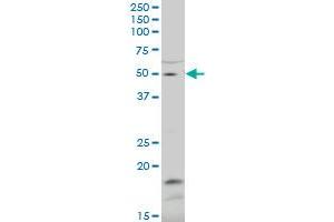 ZNF83 polyclonal antibody (A01), Lot # 051115JC01.