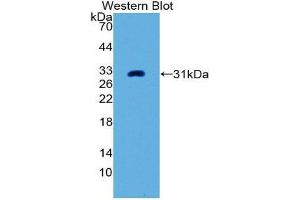 Image no. 1 for anti-Placental Alkaline Phosphatase (ALPP) (AA 68-313) antibody (ABIN2119774)