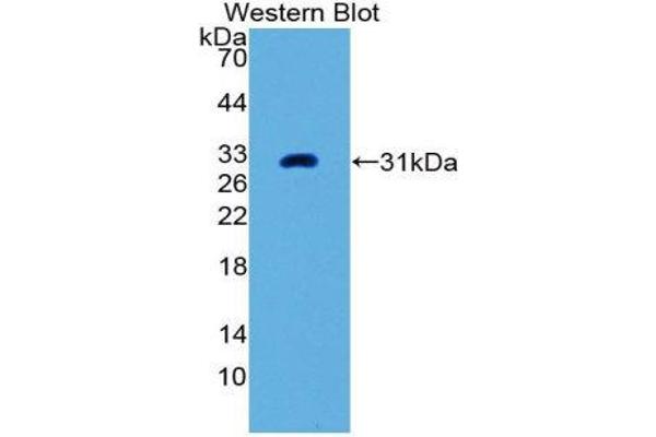 anti-Placental Alkaline Phosphatase (ALPP) (AA 68-313) antibody