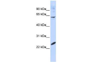 Image no. 1 for anti-SMAD Family Member 4 (SMAD4) (N-Term) antibody (ABIN2780673)