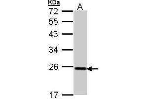 WB Image Sample (30 ug of whole cell lysate) A: Hep G2 , 12% SDS PAGE antibody diluted at 1:1000