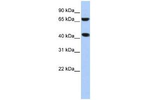 Image no. 1 for anti-ELAC1 (ELAC1) antibody (ABIN631711)