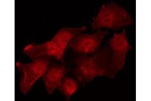 Image no. 5 for anti-Proto-oncogene tyrosine-protein kinase Src (Src) (pTyr530) antibody (ABIN6256758)