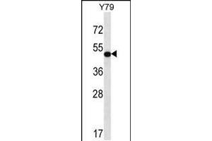 Image no. 1 for anti-Homeobox A13 (HOXA13) (AA 356-383), (C-Term) antibody (ABIN5531398)