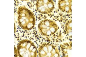 Image no. 13 for anti-ELAV (Embryonic Lethal, Abnormal Vision, Drosophila)-Like 1 (Hu Antigen R) (ELAVL1) antibody (ABIN3022231)