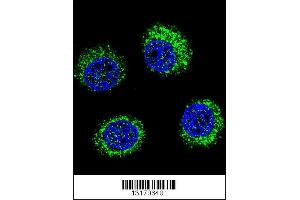 Image no. 3 for anti-Solute Carrier Family 25 (Mitochondrial Carrier, Adenine Nucleotide Translocator), Member 31 (SLC25A31) (AA 139-167) antibody (ABIN5535729)