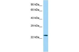 Image no. 1 for anti-Ets Variant 3-Like (ETV3L) (Middle Region) antibody (ABIN2783141)