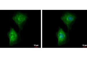 Image no. 1 for anti-phosphodiesterase 4B, cAMP-Specific (PDE4B) (Center) antibody (ABIN2855496)