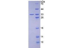 Image no. 3 for Complement Component 1, Q Subcomponent Binding Protein (C1QBP) ELISA Kit (ABIN6574185)