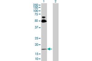 Image no. 1 for anti-Ras Homolog Gene Family, Member B (RHOB) (AA 1-196) antibody (ABIN513473)