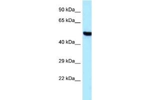 Image no. 1 for anti-threonyl-tRNA Synthetase 2, Mitochondrial (TARS2) (C-Term) antibody (ABIN2789298)